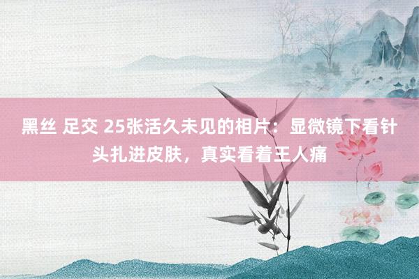 黑丝 足交 25张活久未见的相片：显微镜下看针头扎进皮肤，真实看着王人痛